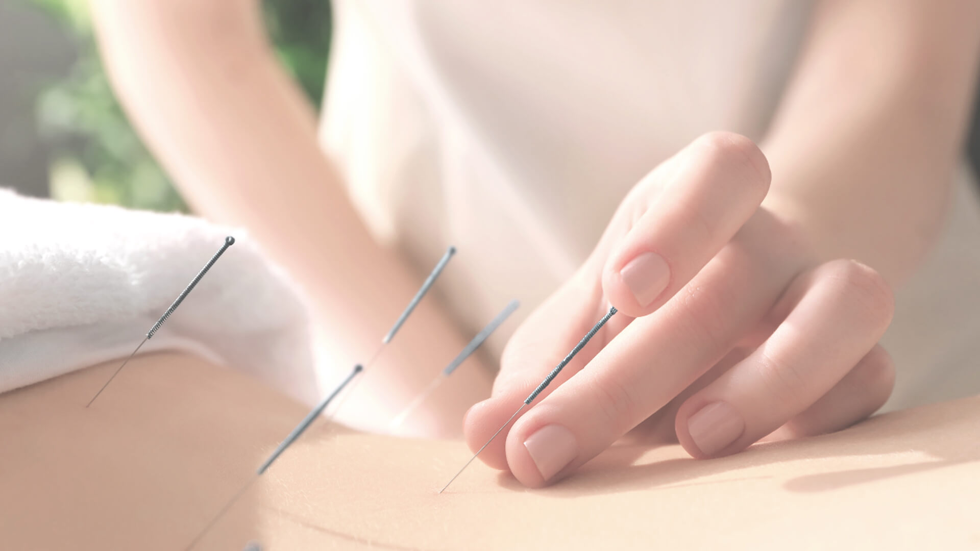 acupuncture therapy singapore