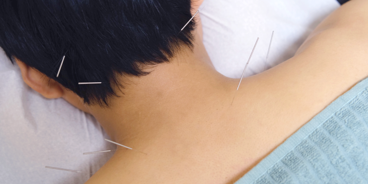 acupuncture services available