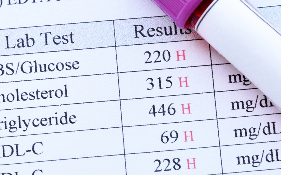 What Does an Abnormal Blood Sugar Result Mean Next Steps After Your Test